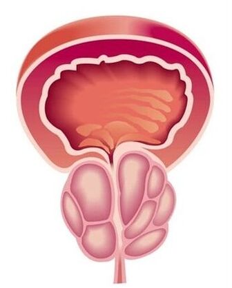 Objawy zapalenia gruczołu krokowego u mężczyzn